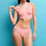 What Makes A Tummy Tuck Medically Necessary